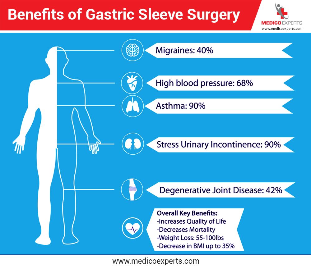 Gastric Sleeve Surgery in India Complete Guide