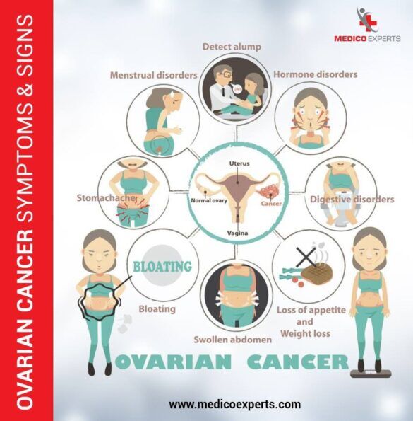 Advanced Ovarian cancer treatment in India